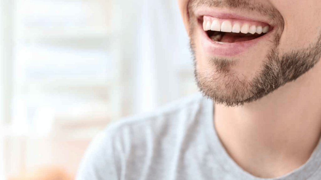 Teeth Whitening (1)